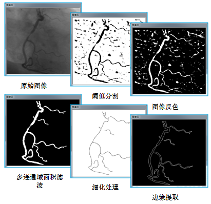 機(jī)器視覺的常用術(shù)語